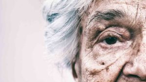 بیماری های پوستی در افراد مسن